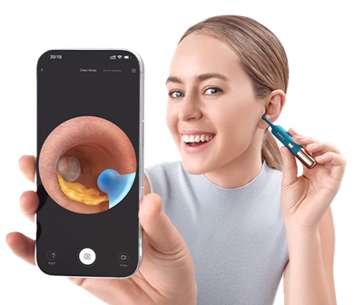 کیفیت دوربین گوش پاک کن هوشمند Bebird Earsight Ultra